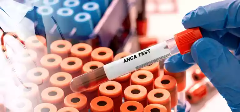 c-ANCA and p-ANCA test: A complete overview of the ANCA test